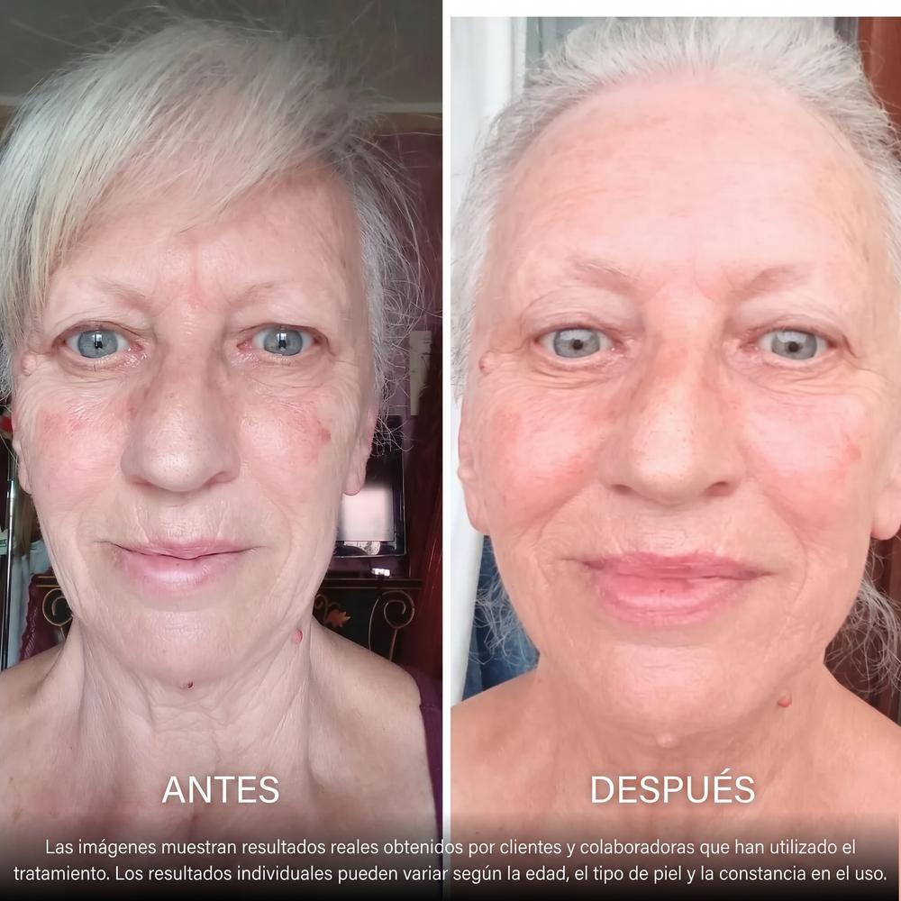 Labios más llenos y definidos de forma natural