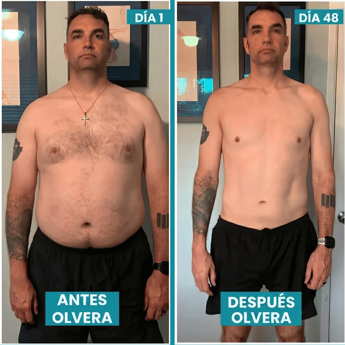Antes / Después Olvera™ — resultados tras 30 días