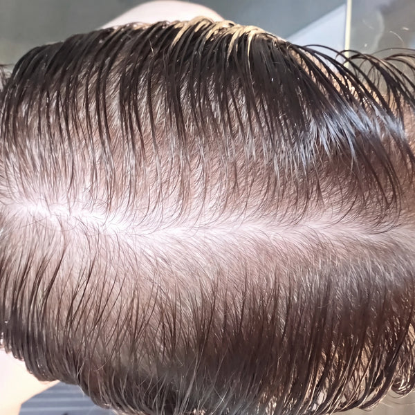 ANTES
